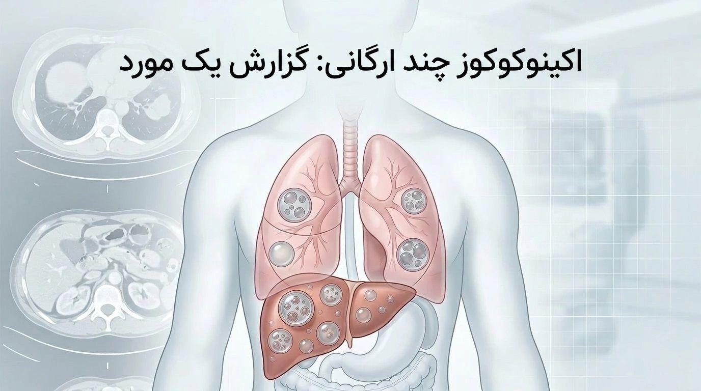 اکینوکوکوز چند ارگانی: گزارش یک مورد